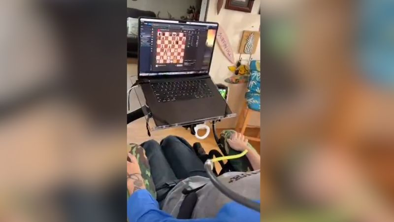 Первый пациент Neuralink с мозговым имплантом продемонстрировал, как играет в шахматы на компьютере